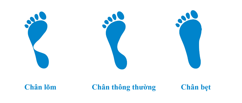 kiểm tra hình dạng bàn chân